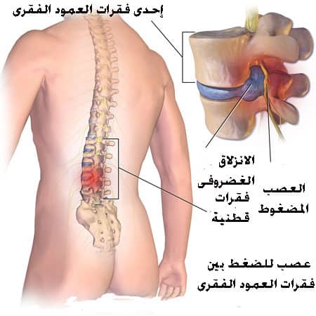 اسباب الام المؤخرة عند الجلوس