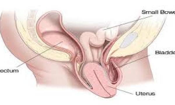 علاج هبوط الرحم في الطب النبوي