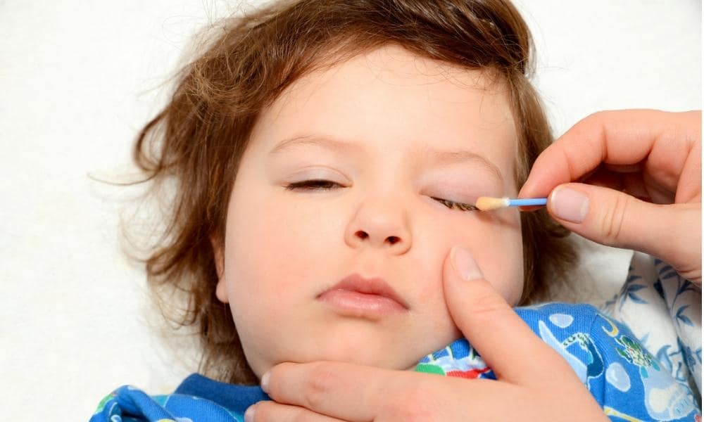 افضل قطرة لاحمرار العين للاطفال